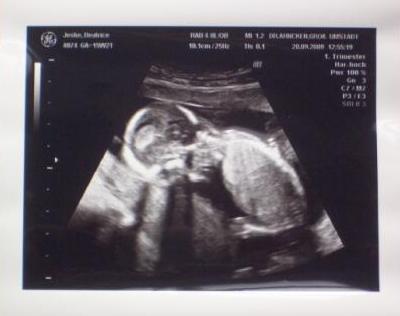 Bild zu US Bilder von gestern - Forum für März - Mamis