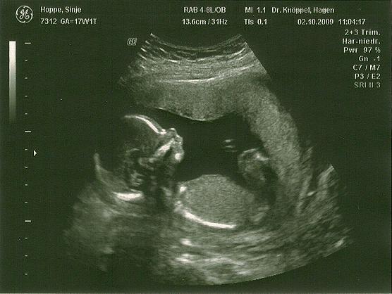 Bild zu Wieder  Zurückvon VU - Forum für März - Mamis