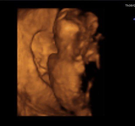 Bild zu VU Bericht - Forum für März - Mamis