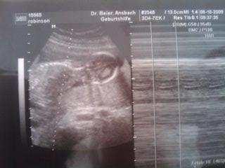 Bild zu zurueck vom FA + OUTING!!!! - Forum für März - Mamis