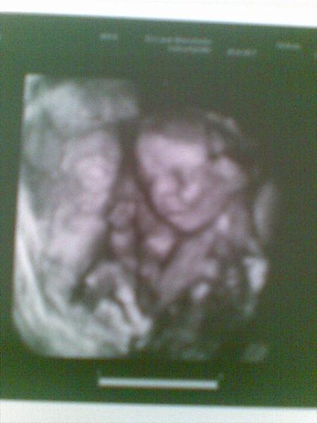 Bild zu Heute VU gehabt :-)  mit FOTO :-) - Forum für März - Mamis