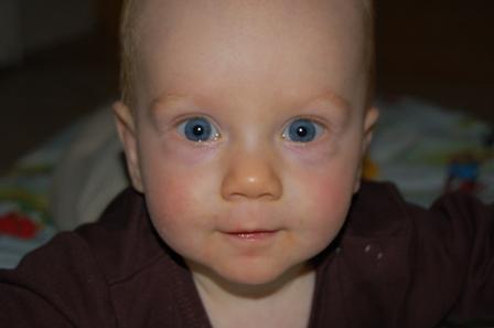 Bild zu 