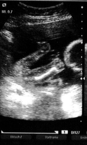 Bild zu Ist das eindeutig??? - Forum für März - Mamis