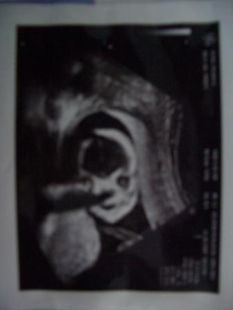 Bild zu Gestern VU mit Bildchen... - Forum für März - Mamis