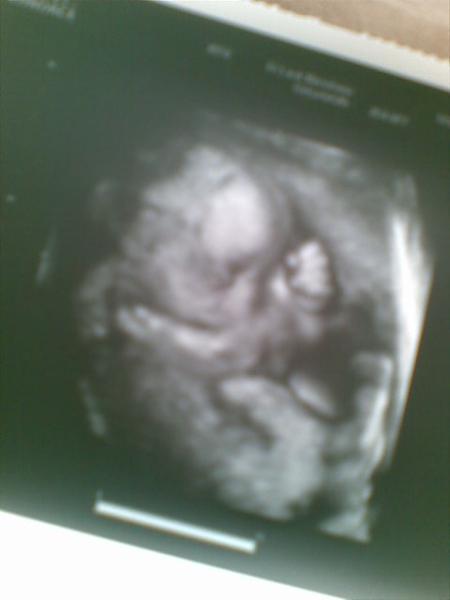 Bild zu Zurück von der VU mit 3D-Fotos, und Kinderarzt Bericht - Forum für März - Mamis