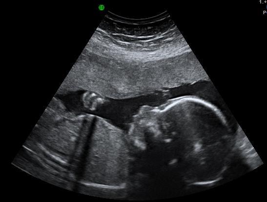 Bild zu so und hier unser Sohn einmal im Profil ... - Forum für März - Mamis