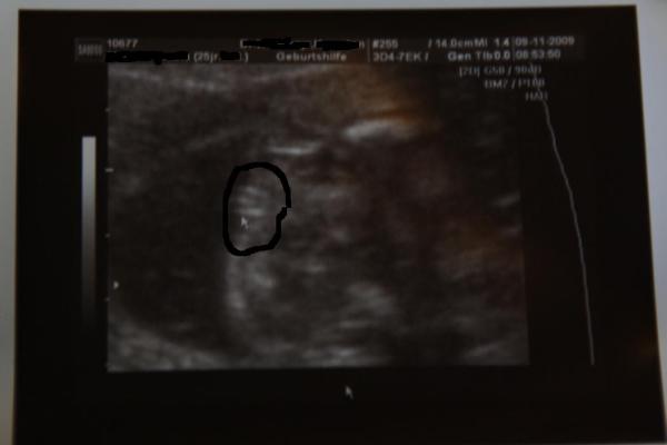 Bild zu Außerplanmässig beim Doc + 100% Outing (mit Foto)! - Forum für März - Mamis