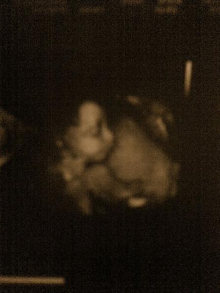 Bild zu Heute VU Bericht mit Bildchen ;-) - Forum für März - Mamis