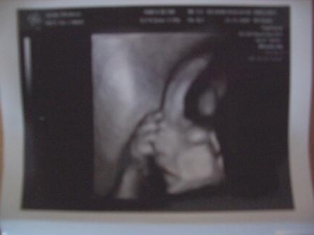 Bild zu VU gestern mit 3D Bildchen - Forum für März - Mamis