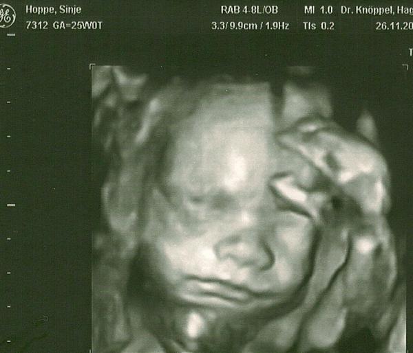 Bild zu VU Zuckertest und 4D Bildchen :) - Forum für März - Mamis