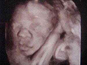 Bild zu War gestern auch zur VU - Forum für März - Mamis