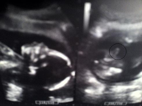 Bild zu Mein kleiner Mann ... - Forum für März - Mamis