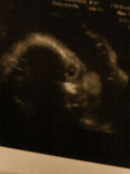 Bild zu Hier die Vergleichsbilder :-) - Forum für März - Mamis