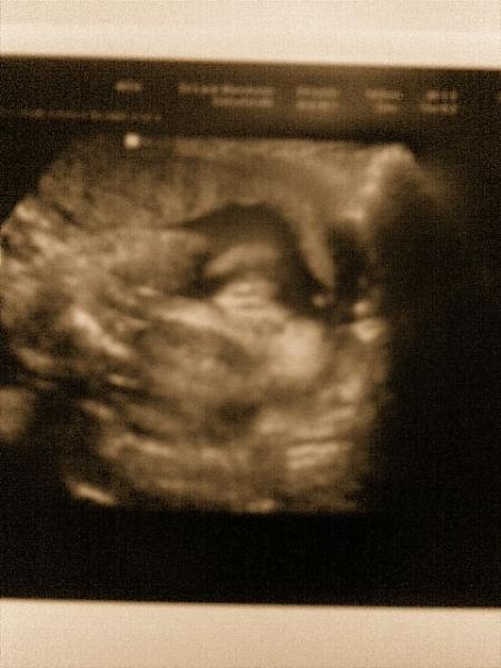 Bild zu Das Mädchen Beweis-foto und neues Bauchfoto :-) - Forum für März - Mamis