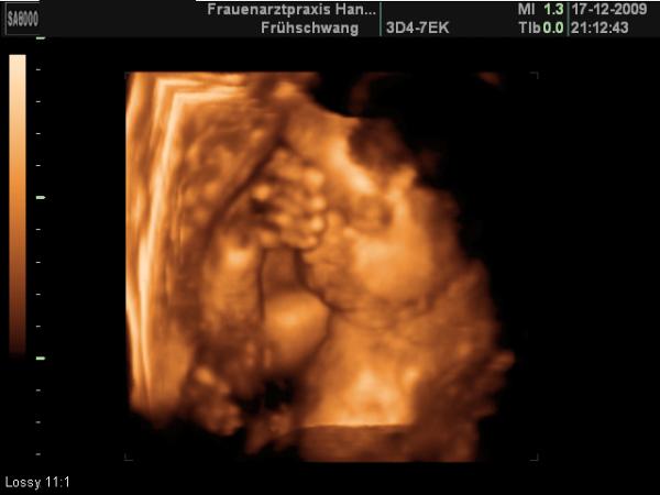 Bild zu 3d Bilder von gestern, Nr.1 - Forum für März - Mamis