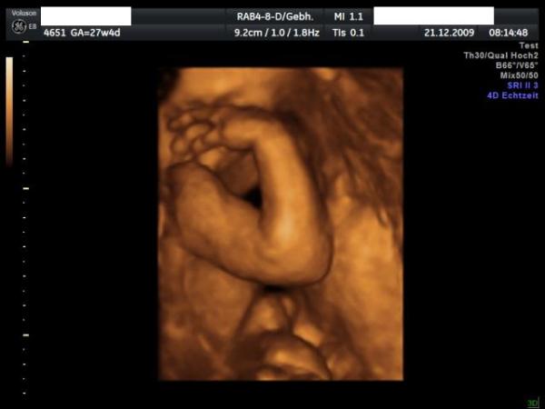 Bild zu gestern VU - Forum für März - Mamis