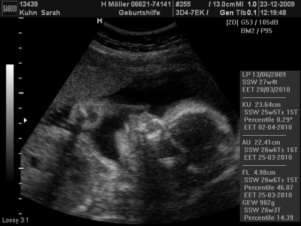 Bild zu Heute war mal wieder ein FA-Termin - Forum für März - Mamis