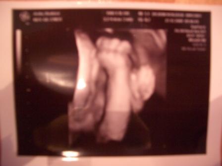 Bild zu 3D Bildchen... - Forum für März - Mamis