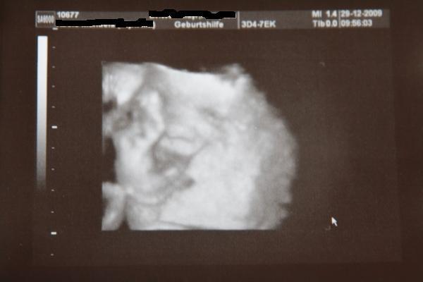 Bild zu Heutige VU.... mit 3D - Forum für März - Mamis