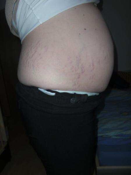 Bild zu Vu Bericht+Bauchbild - Forum für März - Mamis