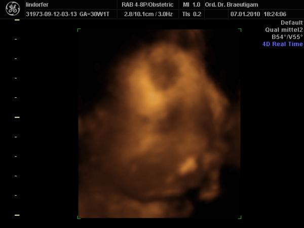 Bild zu 3D Bilder #1 - Forum für März - Mamis