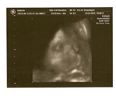 Bild zu 3D Foto - Forum für März - Mamis