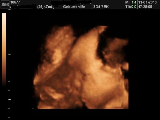 Bild zu VU Bericht und 3D Foto - Forum für März - Mamis