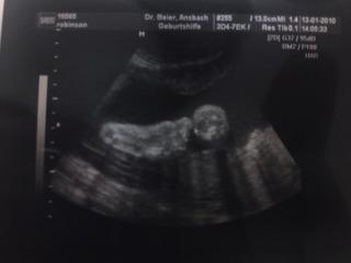 Bild zu VU gestern! - Forum für März - Mamis