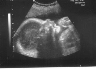 Bild zu Gestern VU (mit Bild) - Forum für März - Mamis