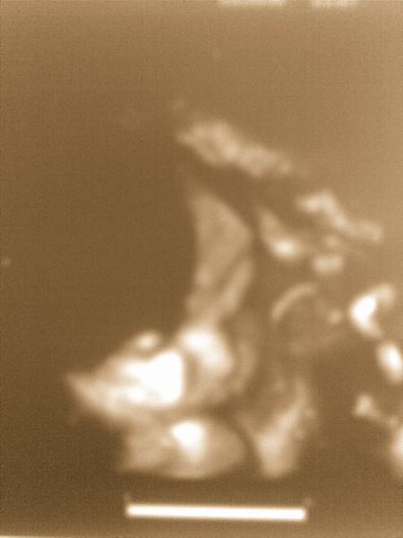 Bild zu Wieder da von der VU mit 3D Foto ! - Forum für März - Mamis