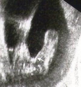 Bild zu @Krissel06 (Mädchen???) - Forum für März - Mamis