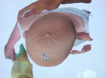 Bild zu Schädelasymetrie / Kiss oder doch andere Ursachen - Forum für März - Mamis