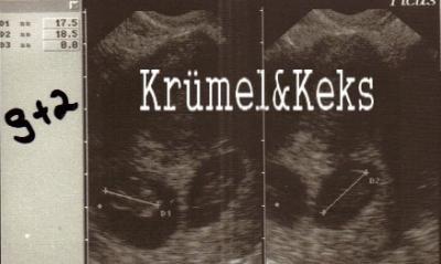 Bild zu Zurück vom FA mit BILD :D - Forum für März - Mamis