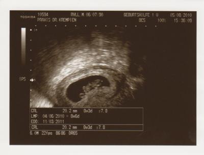 Bild zu So ich bin wieder da... - Forum für März - Mamis