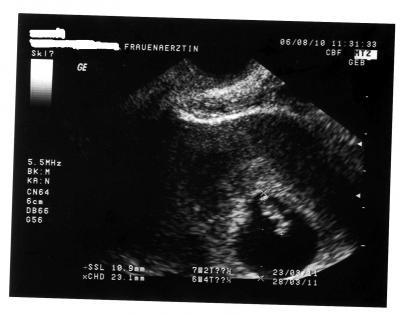 Bild zu Krümelchen geht es gut - Forum für März - Mamis