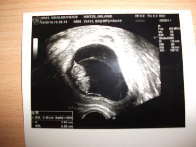 Bild zu ich hatte euch freitag gar nicht mein bild gezeigt - Forum für März - Mamis