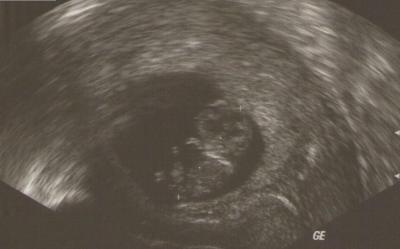 Bild zu US-Bild vom Mini - Forum für März - Mamis