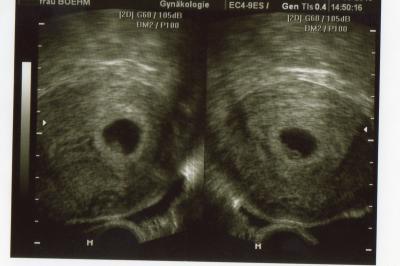 Bild zu US Bilder 6+0 und 8+0 - Forum für März - Mamis