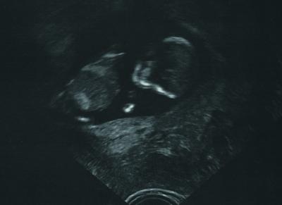 Bild zu US-Fotos - Forum für März - Mamis