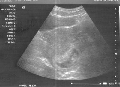 Bild zu Zurück vom Baby gucken! :-) - Forum für März - Mamis