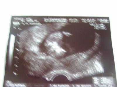 Bild zu FA Termin - Forum für März - Mamis