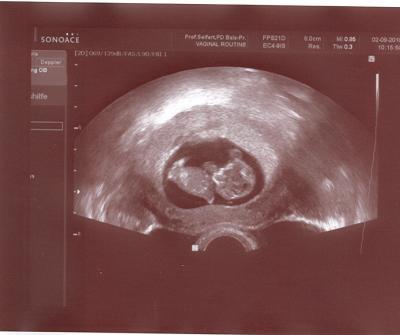 Bild zu Krümelbilder - Forum für März - Mamis