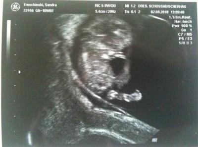Bild zu US-Bild von Donnerstag :-) - Forum für März - Mamis