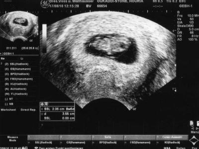 Bild zu HEY BIN NEU HIER !! - Forum für März - Mamis