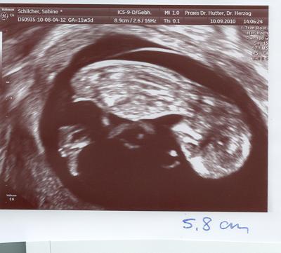Bild zu Baby gehts gut - Forum für März - Mamis