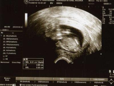 Bild zu BIN WIEDER DA !! - Forum für März - Mamis