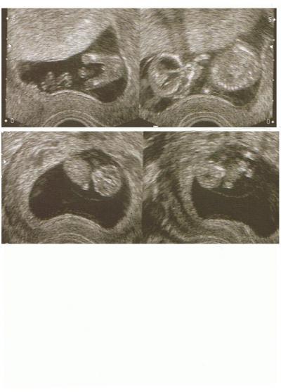 Bild zu Bildchen von Krümmel - Forum für März - Mamis