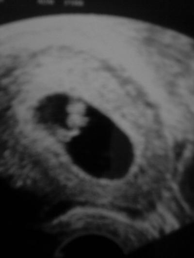 Bild zu wollt euch auch mal gerne meine bildchen vom krümel zeigen =) - Forum für März - Mamis