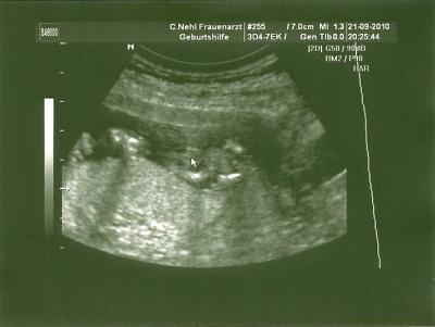 Bild zu Ich war beim FA + Outing - Forum für März - Mamis