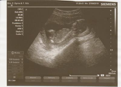 Bild zu Ich bin auch zurück vom FA, aber leider ohne Outing... - Forum für März - Mamis